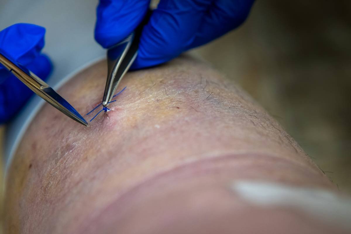 special effects makeup for scars: the pro’s playbook for hyperrealistic trauma